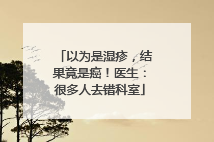 以为是湿疹，结果竟是癌！医生：很多人去错科室